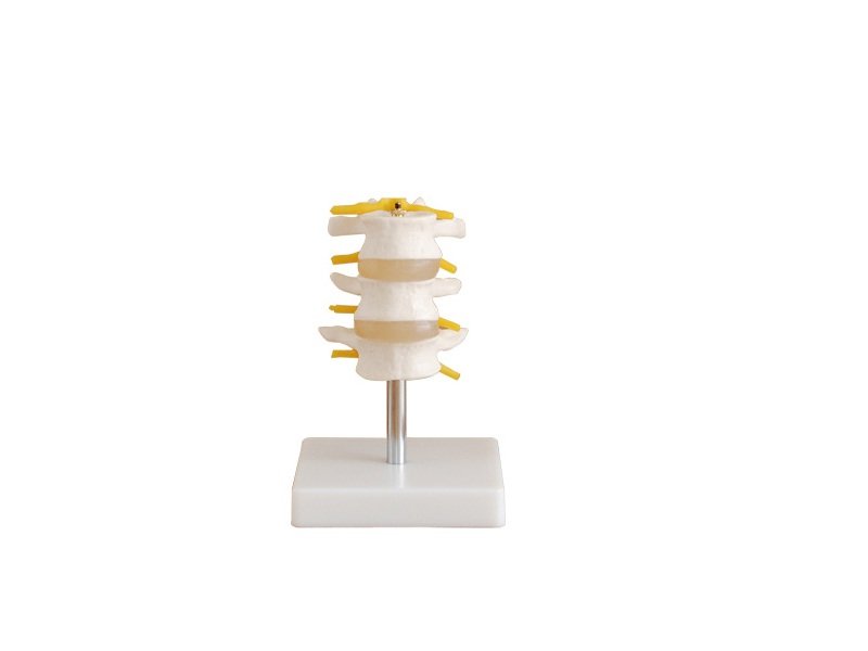 Modelo de Vertebras Lumbares
